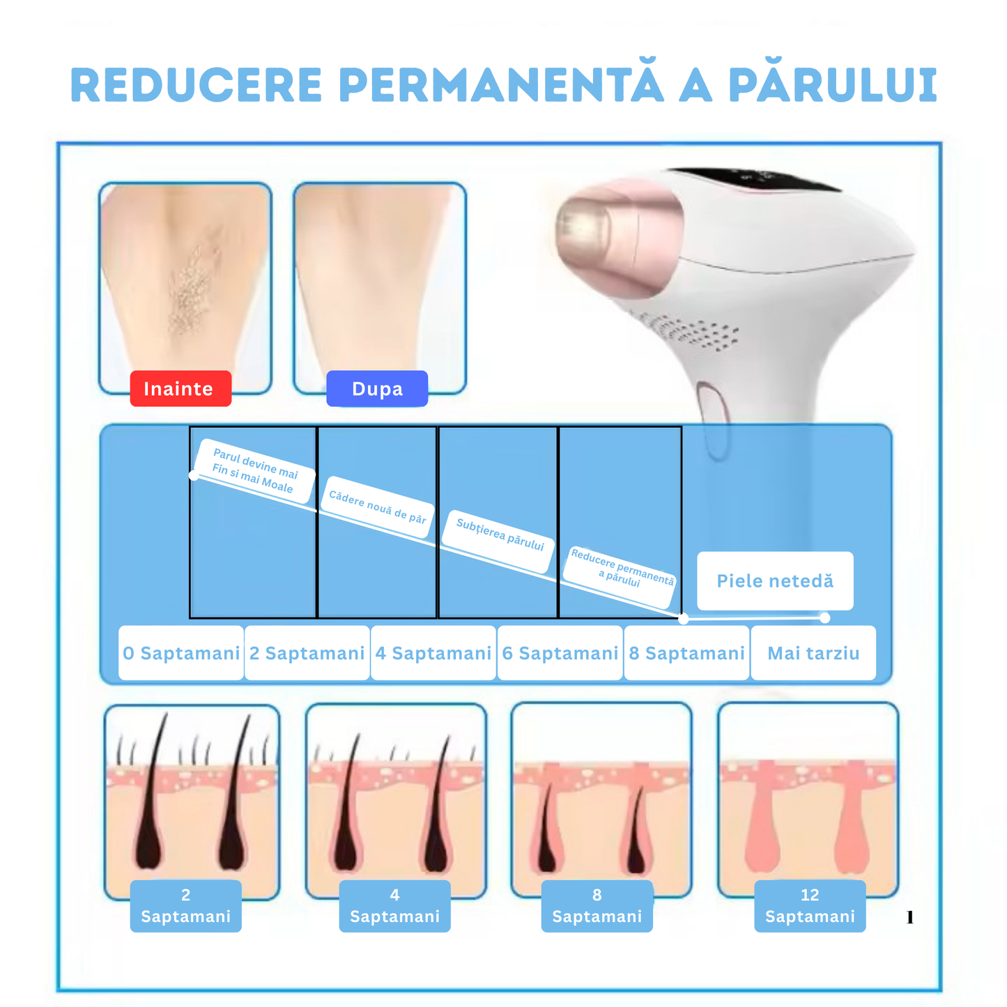 Epilator IPL TrustTech 3 Moduri Epilare Definitiva -Rejuvenare-Reducere Acnee, Racire cu gheata