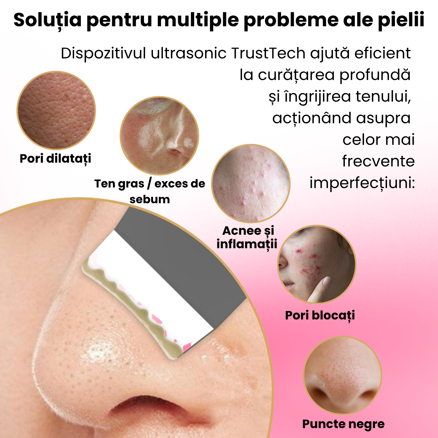 Scrubber Curatat piele Ultrasonic 4-in-1 TrustTech cu ionizare si EMS– Spatula Profesionala pentru Curatare Faciala