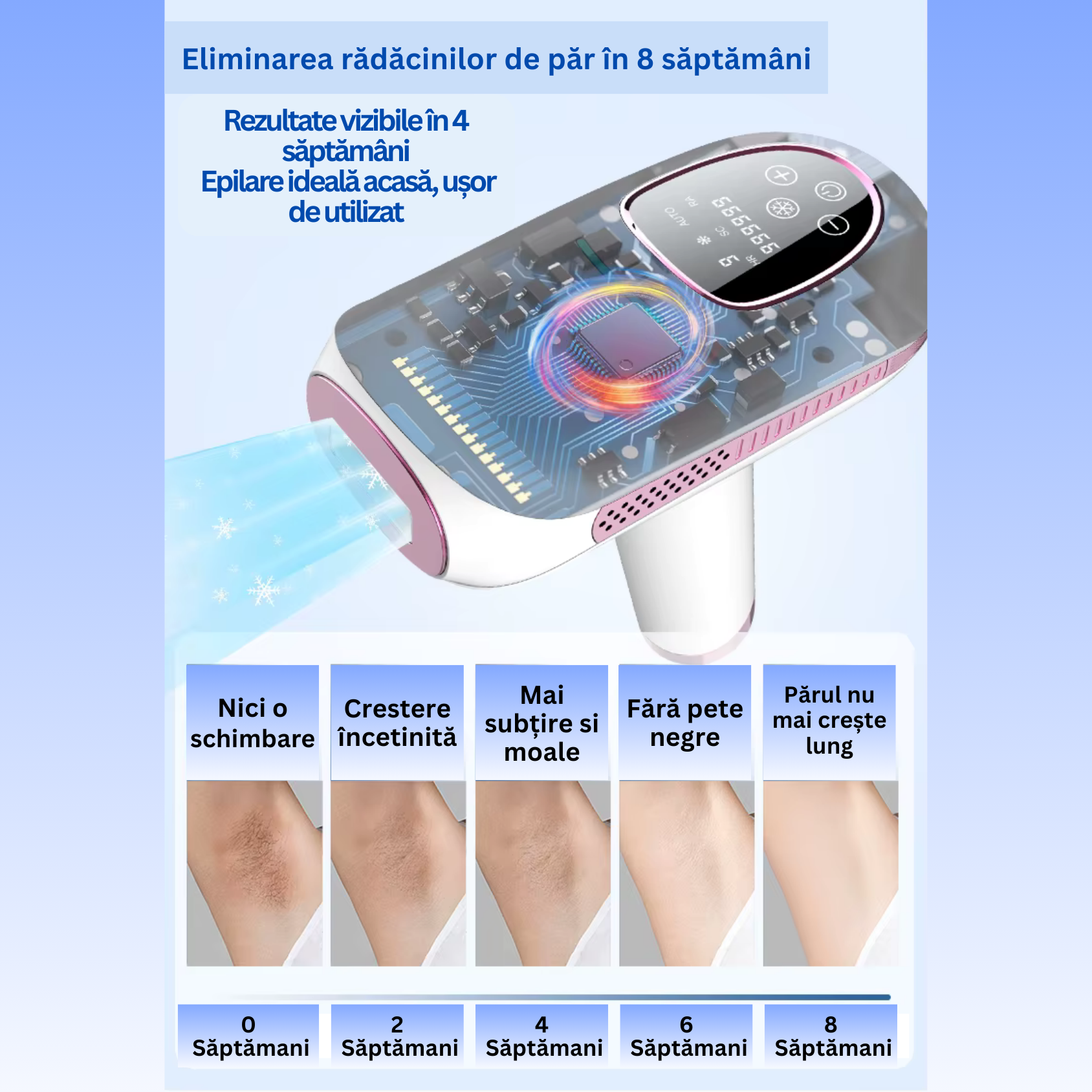 Epilator IPL TrustTech Ice Cooling  epilare definitiva fara durere